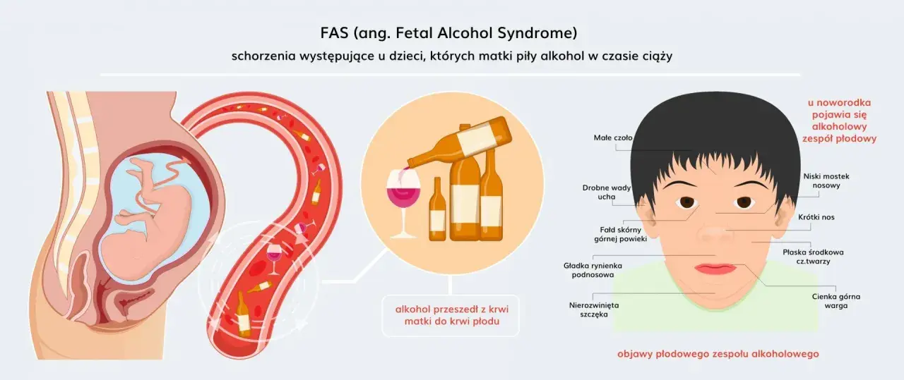 Ilustracja pokazuje płód w łonie matki, butelki alkoholu i dziecko z cechami FAS. Alkohol przechodzi z krwi matki do płodu, powodując zaburzenia.